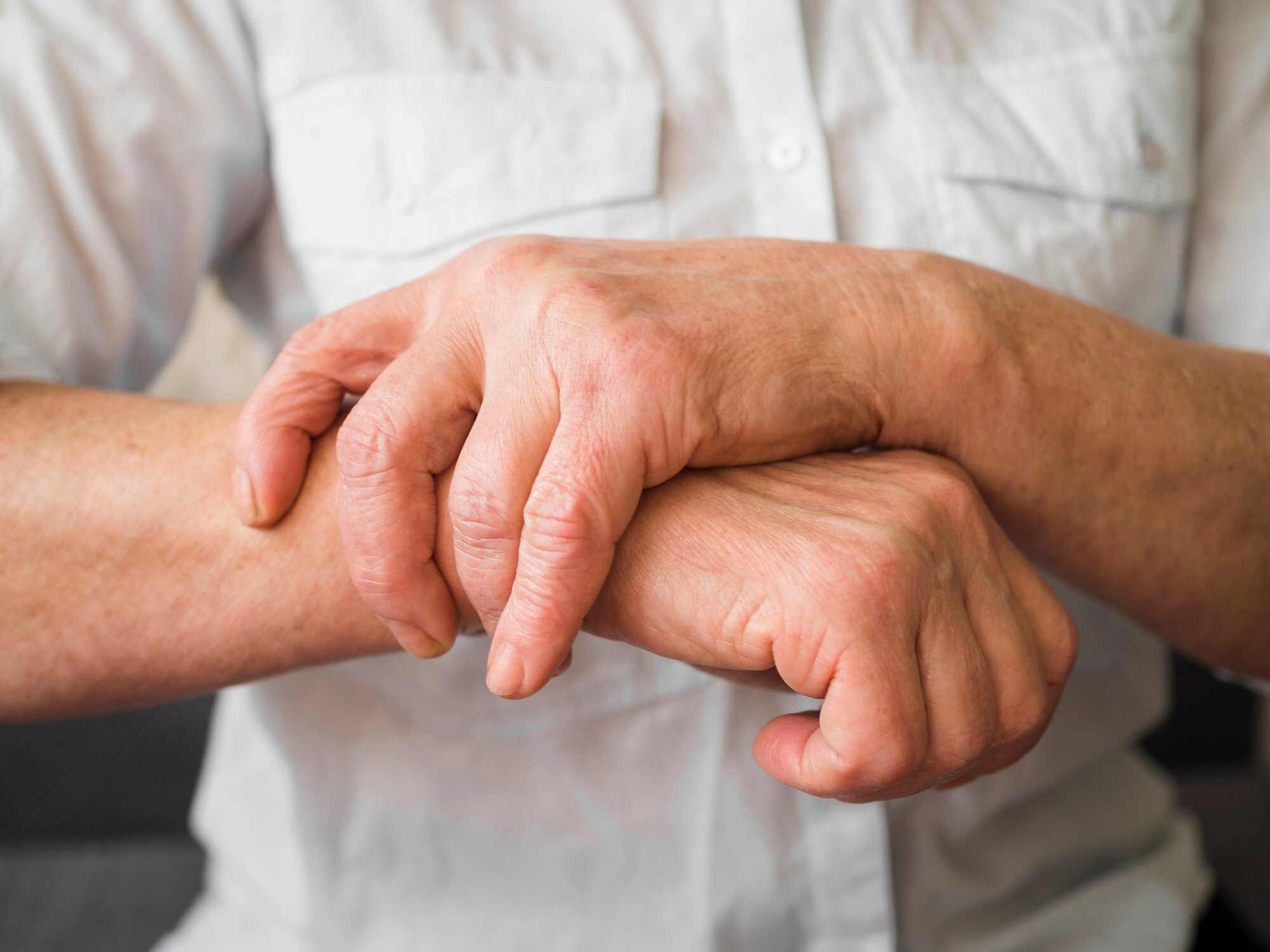 primer plano paciente artritis reumatoide